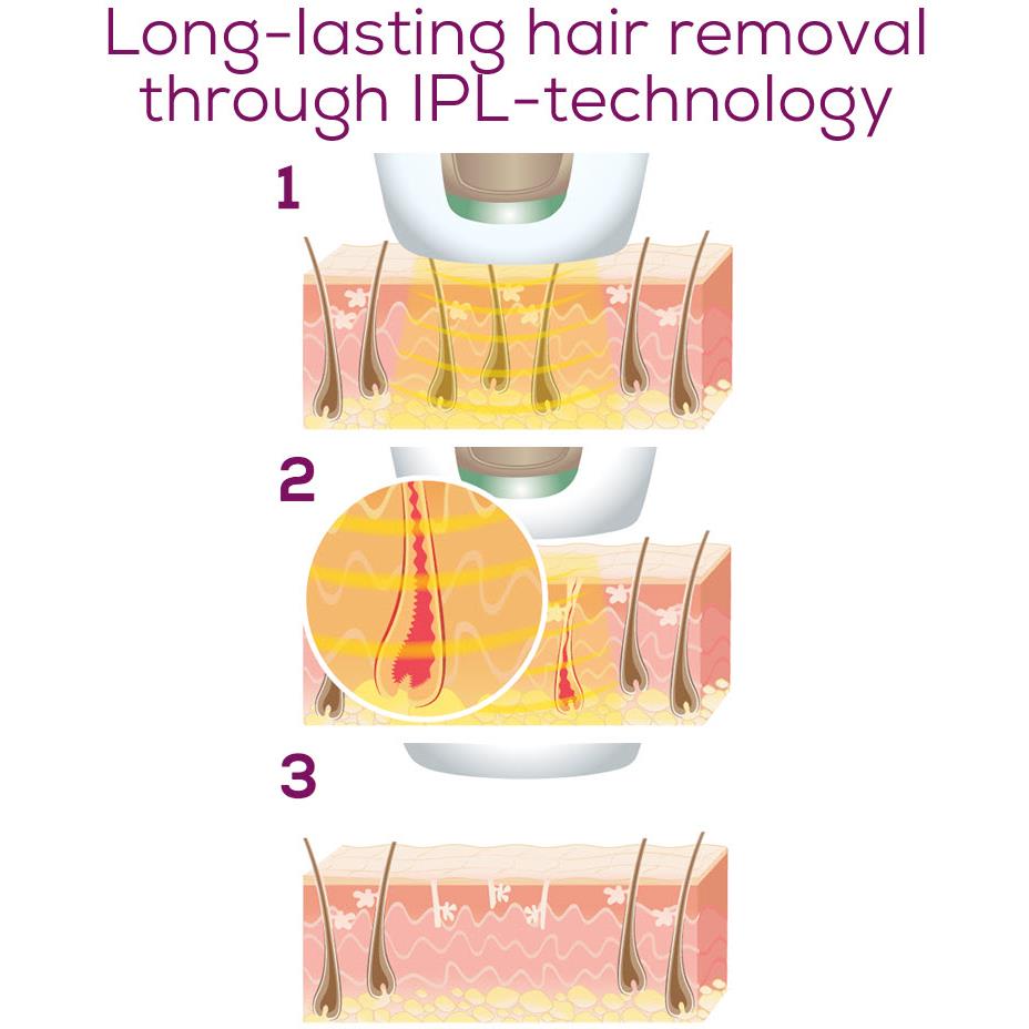 Beurer IPL5800 Pure Skin Pro IPL Hair Removal Device