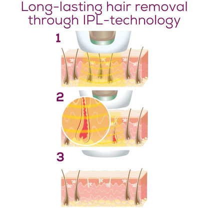 Beurer IPL5800 Pure Skin Pro IPL Hair Removal Device